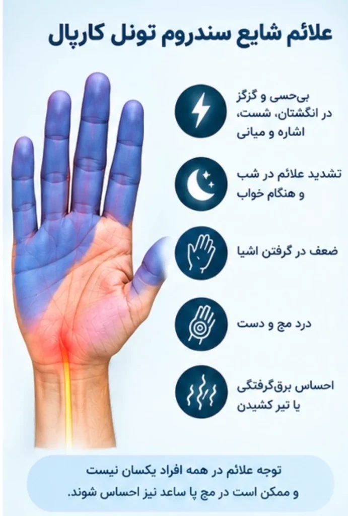 علائم سندروم تونل کارپال