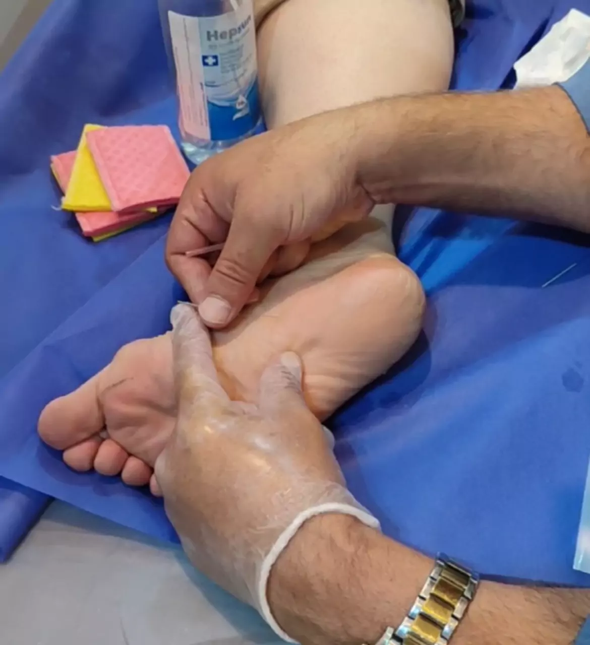 سوزن-درمانی-نیروی-مسلح