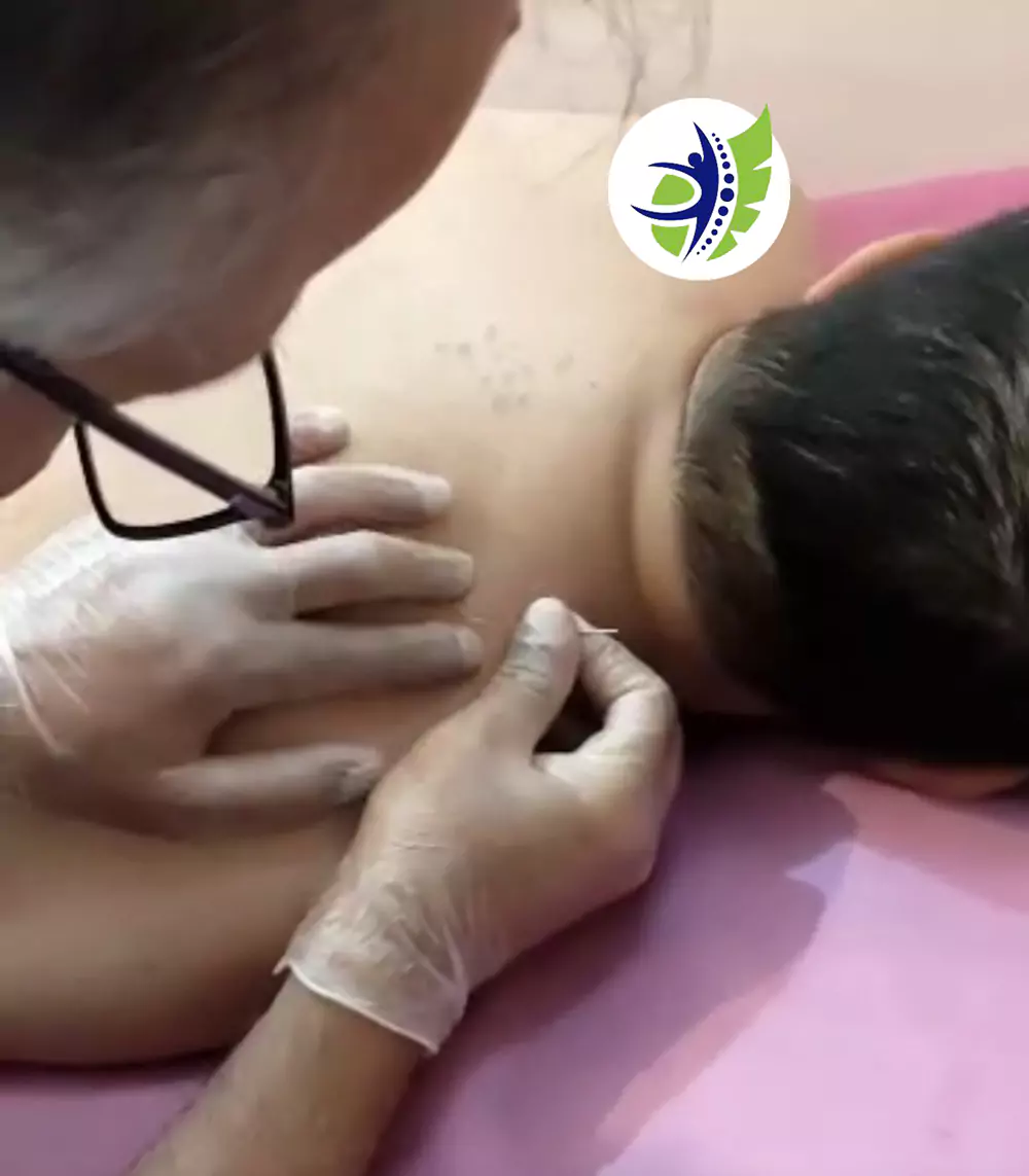 طب-سوزنی-درد-گردن